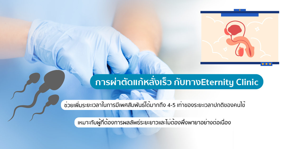 ผ่าตัดแก้หลั่งเร็ว